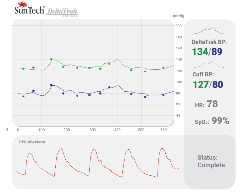 Artistic Rendering of the DeltaTrak User Interface